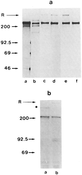 A Electrophoretic Analysis Of 35s Methionine Labeled Proteins