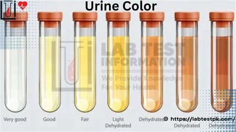 Urine Color Chart - Healthy color of | Lab Test Information