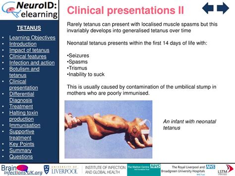 Ppt Tetanus Learning Objectives Introduction Impact Of Tetanus Clinical Features Infection And