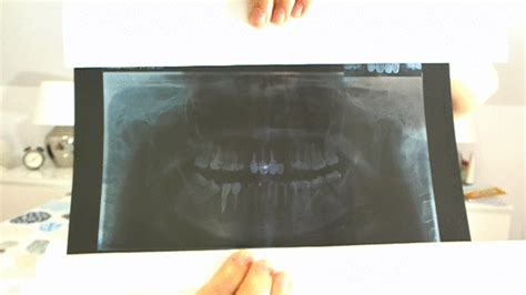 Fetishgoddess Dental Xray