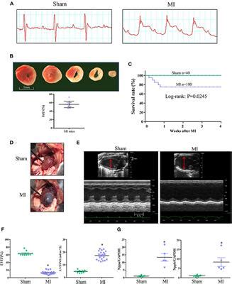 Frontiers A Modified Surgical Ventricular Reconstruction In Post