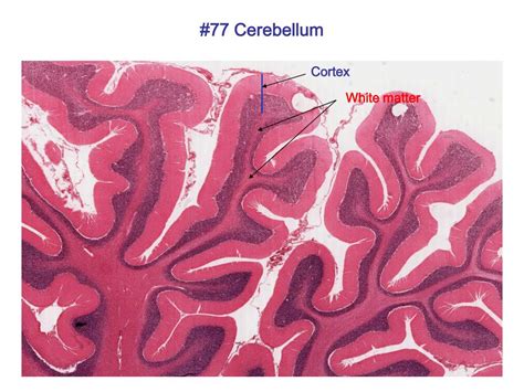 Cerebellum Histology Drawing