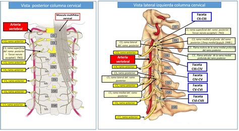 Arterias Vertebrales Dolopedia