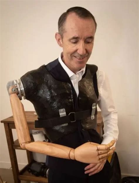 Leeds Man Makes New Arm Out Of Mannequin