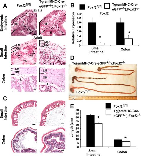 Decreased Foxf And Length Of Intestinal Tract In Tg Smmhc Cre Egfp