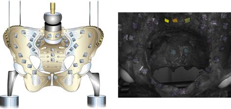 Physiological In Vitro Sacroiliac Joint Motion A Study On Three