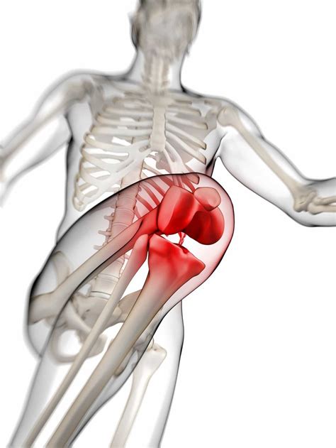 What is Runner's Knee? Symptoms, Causes, and Treatments