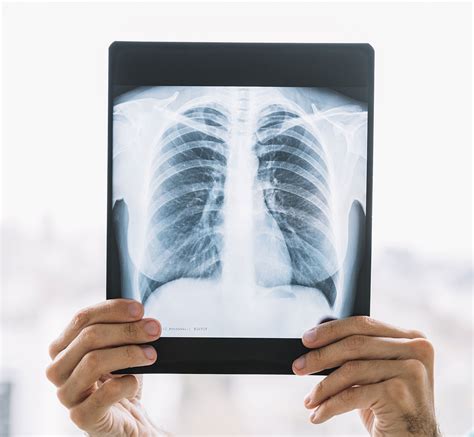 Mobile Chest X Rays Bergmanross Radiologist