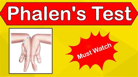 Phalens Test Carpal Tunnel Syndrome Median Nerve Pathology Youtube