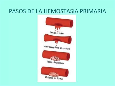 Trastornos De La Hemostasia Ppt Descarga Gratuita