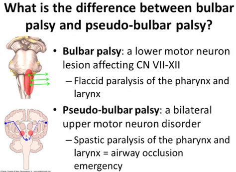 Bulbar and pseudobulbar palsy