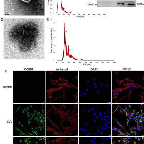 Characterization Of Extracellular Vesicles Evs Isolated From Rat