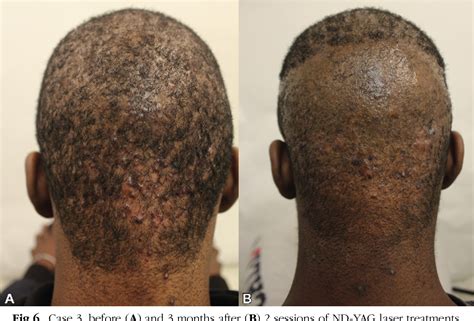 Figure From Selection Criteria And Techniques For Improved Cosmesis