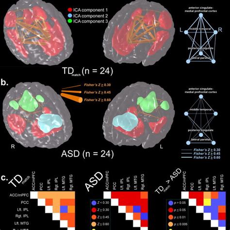 Comparisons Between The Internodal Dmn Functional Connectivity Of Download Scientific Diagram