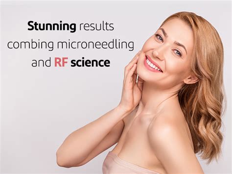 Fractional RF Needling Unlocking Radiant Skin