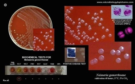 Modified Thayer-Martin Agar: Preparation, Uses • Microbe Online