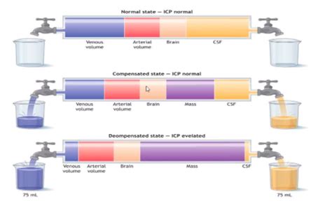 Determinants and Assessment of Cerebral Tissue Perfusion Flashcards | Quizlet