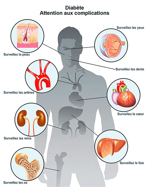 40 000 Nouveaux Cas De Diabète Par An Diabetemagazine