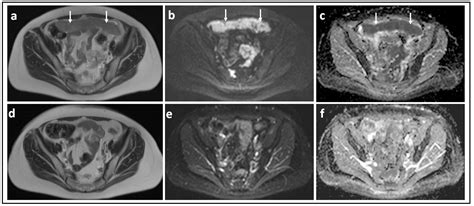 Jcm Free Full Text Diffusion Weighted Magnetic Resonance Imaging In