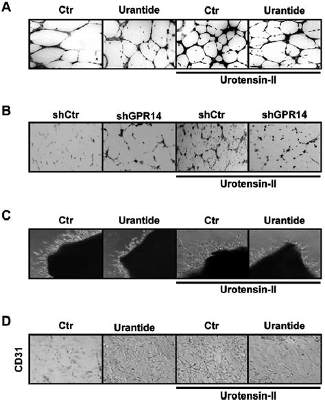 U Ii Stimulates Angiogenesis Through Its Receptor Gpr A Human