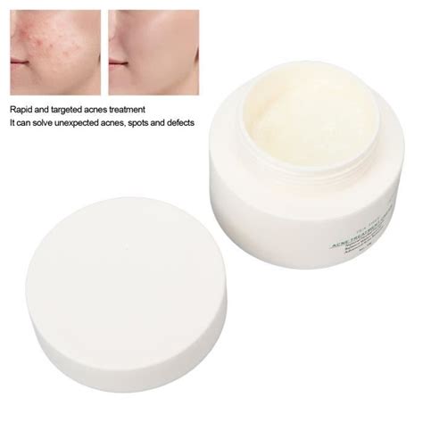 Pwshymi crème pour le visage anti huile Crème contre l acné 30g