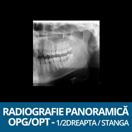 Preturi Tomografie Dentara Pret Radiografii Imagistica Dentara