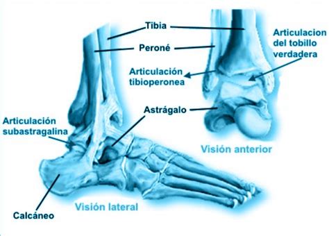 Dr Carlos Godoy Pinzamiento De Tobillo