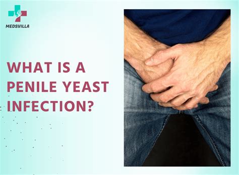 What Is A Penile Yeast Infection