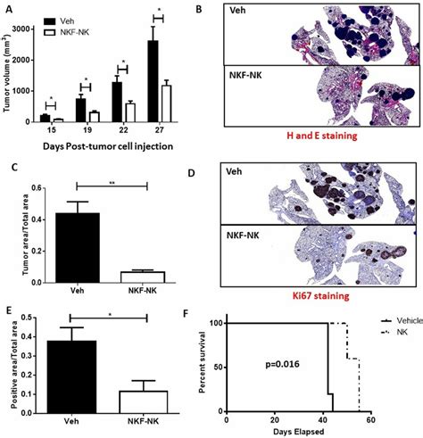 Nkf Nk Cells Reduce Tumor Burden In Mouse Xenografts And Improve Mouse