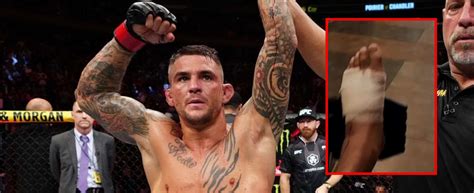 Dustin Poirier Finally Responding To Antibiotics Will Be Discharged From The Hospital Soon