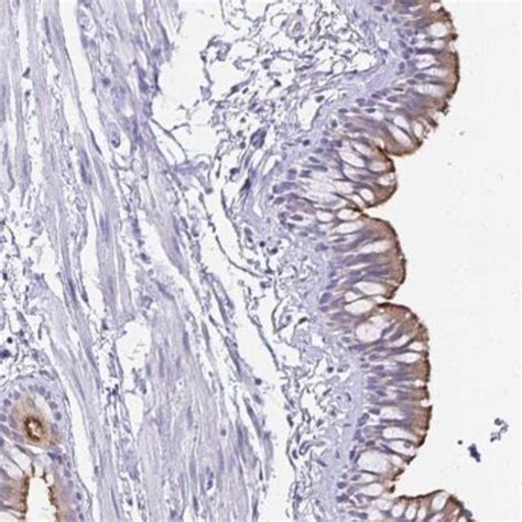 TCTEX1D4 Antibody Novus Biologicals 25 μL Unlabeled Fisher Scientific