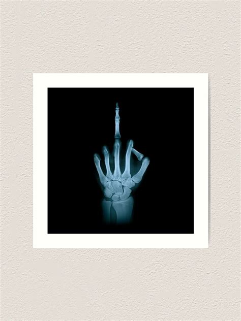 Funny X Ray Middle Finger Anatomy F You Art Print For Sale By