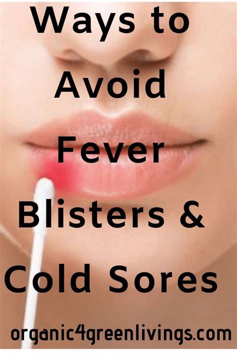 Ways To Avoid Fever Blister And Cold Sores Fever Blister Cold Sore