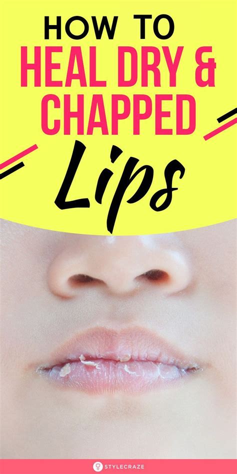 If You Have Dry And Chapped Lips This Is How You Heal Them Natural