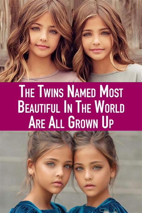 The Twins Named Most Beautiful In The World Are All Grown Up