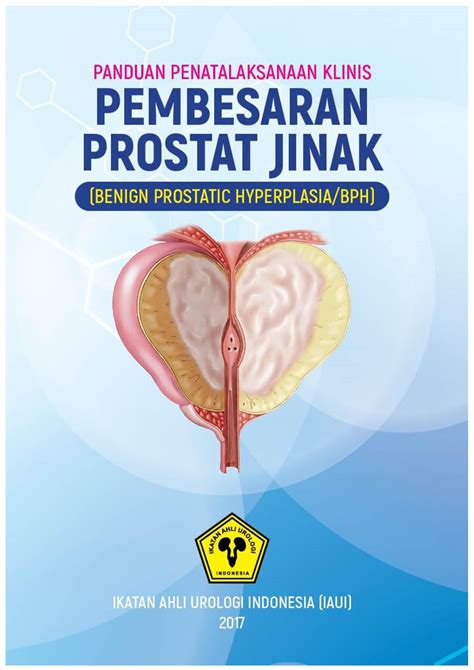 BPH Materi BPH I Panduan Penatalaksanaan Klinis Pembesaran Prostat