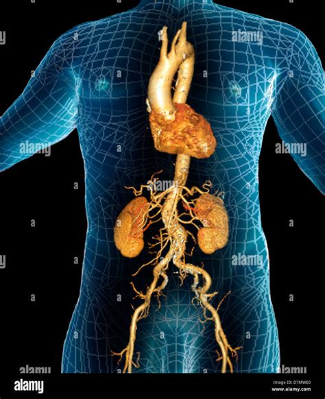 Aorta 3D CT Scan Stock Photo Alamy