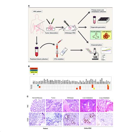 Workflow Of The Orthotopic Pdx Model A Orthotopic Patient Derived