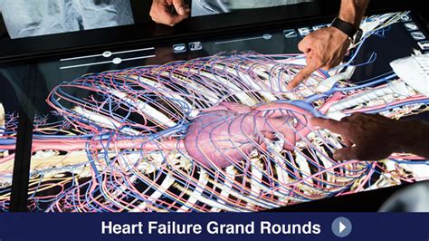 Hemodynamic Assessment Of Heart Failure Mayo Clinic