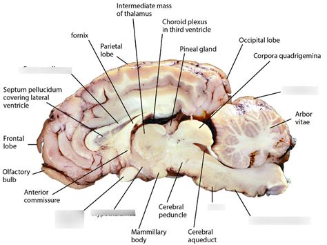 Sheep Brain Sagittal View Diagram Quizlet