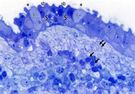 A Photomicrograph Of A Semithin Section Of Human Endometrium Of Rpl