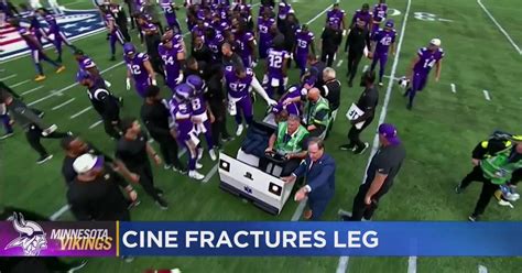 Vikings Lewis Cine Fractures Leg Needs Surgery Cbs Minnesota