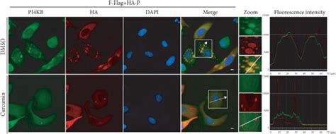 Curcumin Interferes With Colocalization Of Pi Kb In Ibs A Hela Cells