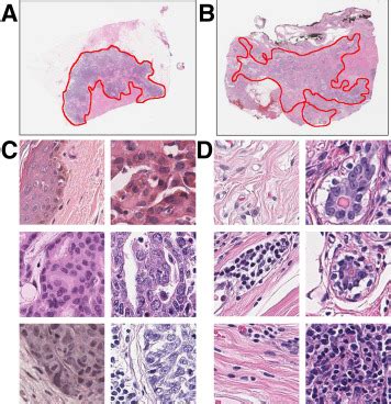 Utilizing Automated Breast Cancer Detection To Identify Spatial