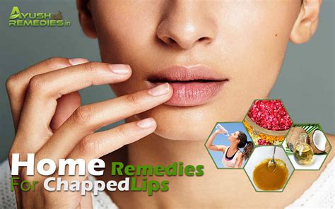 7 Home Remedies For Chapped Lips Have A Beautiful Smile