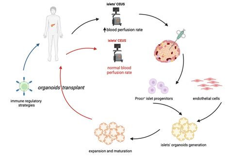 Proposed Cell Based Treatment Of Type Diabetes The Proposed Approach