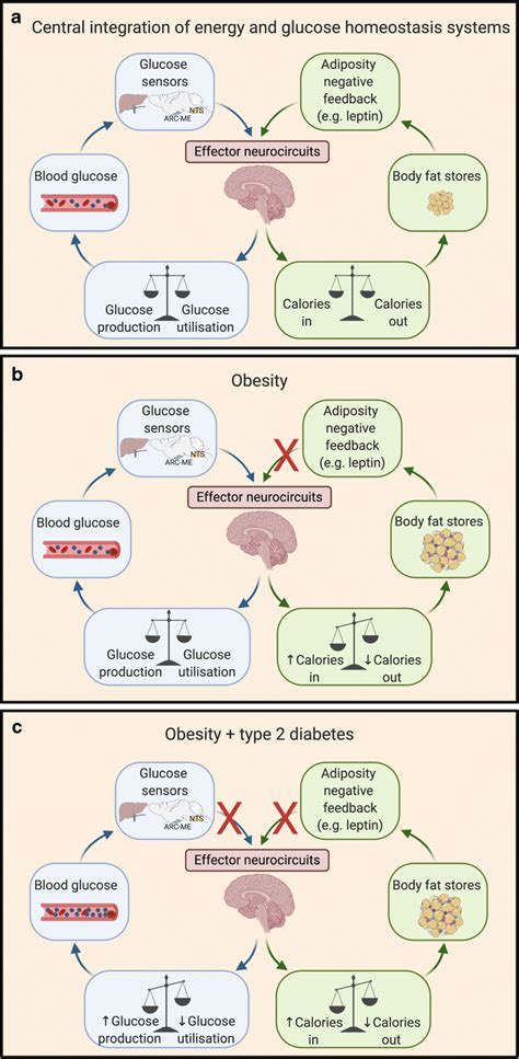 Brain Based Model Linking Obesity To The Pathogenesis Of Type