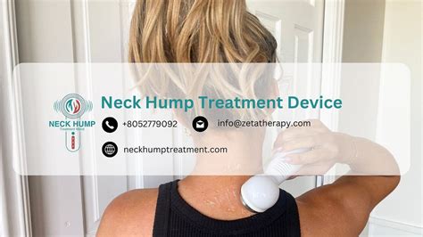 The Neck Hump Treatment Device - A Gentle, Non-Surgical Path to Relief ...