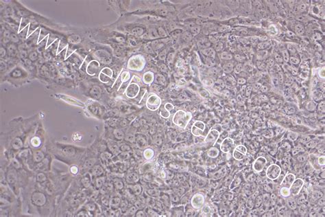 Bewo 人胎盘绒膜癌细胞 原代细胞 Str细胞 细胞培养基 赛百慷生物