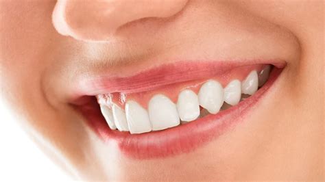 Teeth Whitening Oakville Central Oakville Dental Care